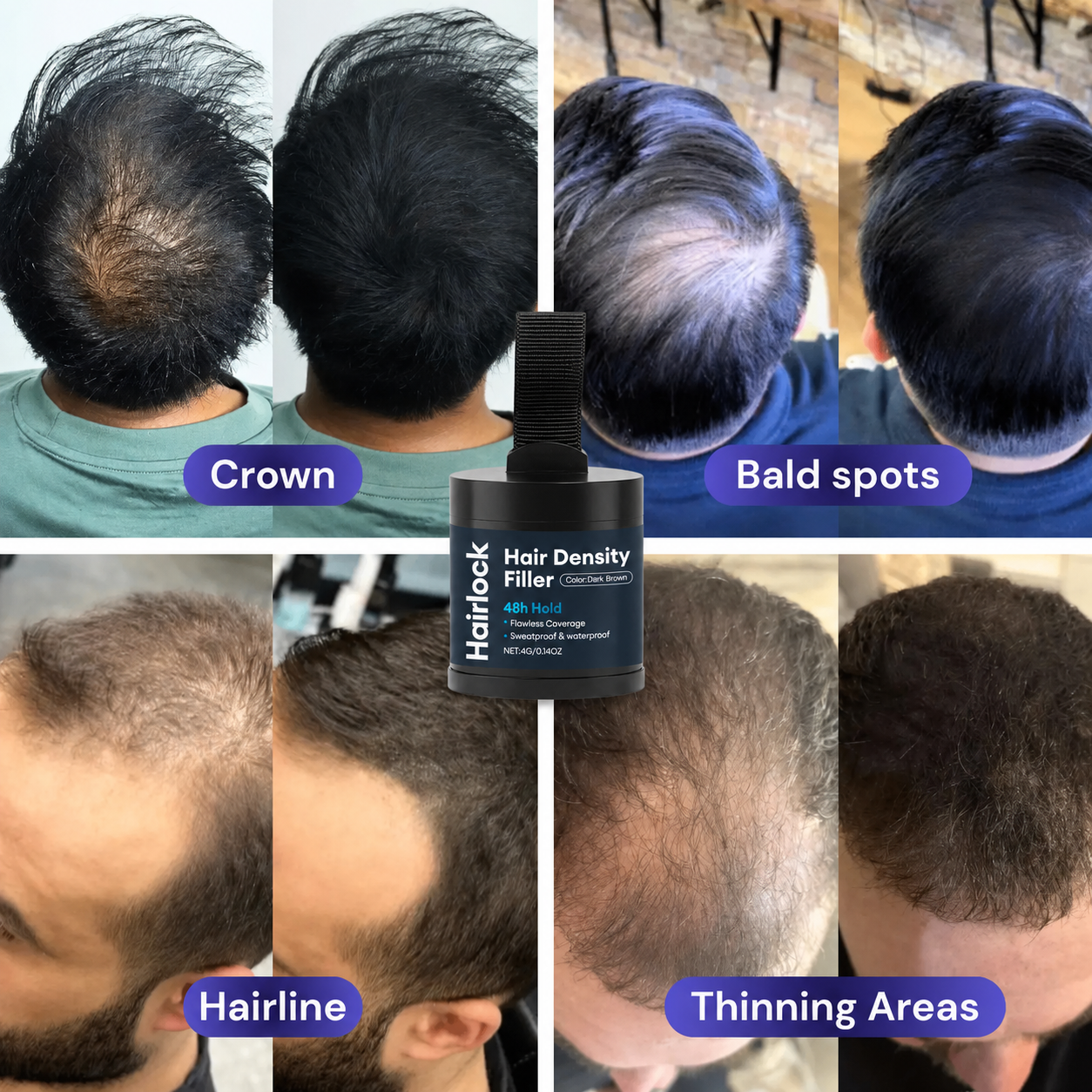 Hair Density Filler
